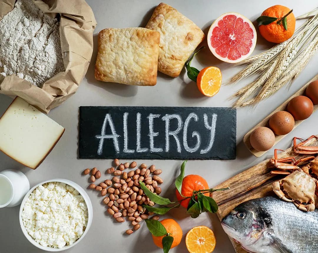 Food Intolerance Test