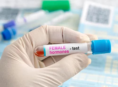 Hormone Test
